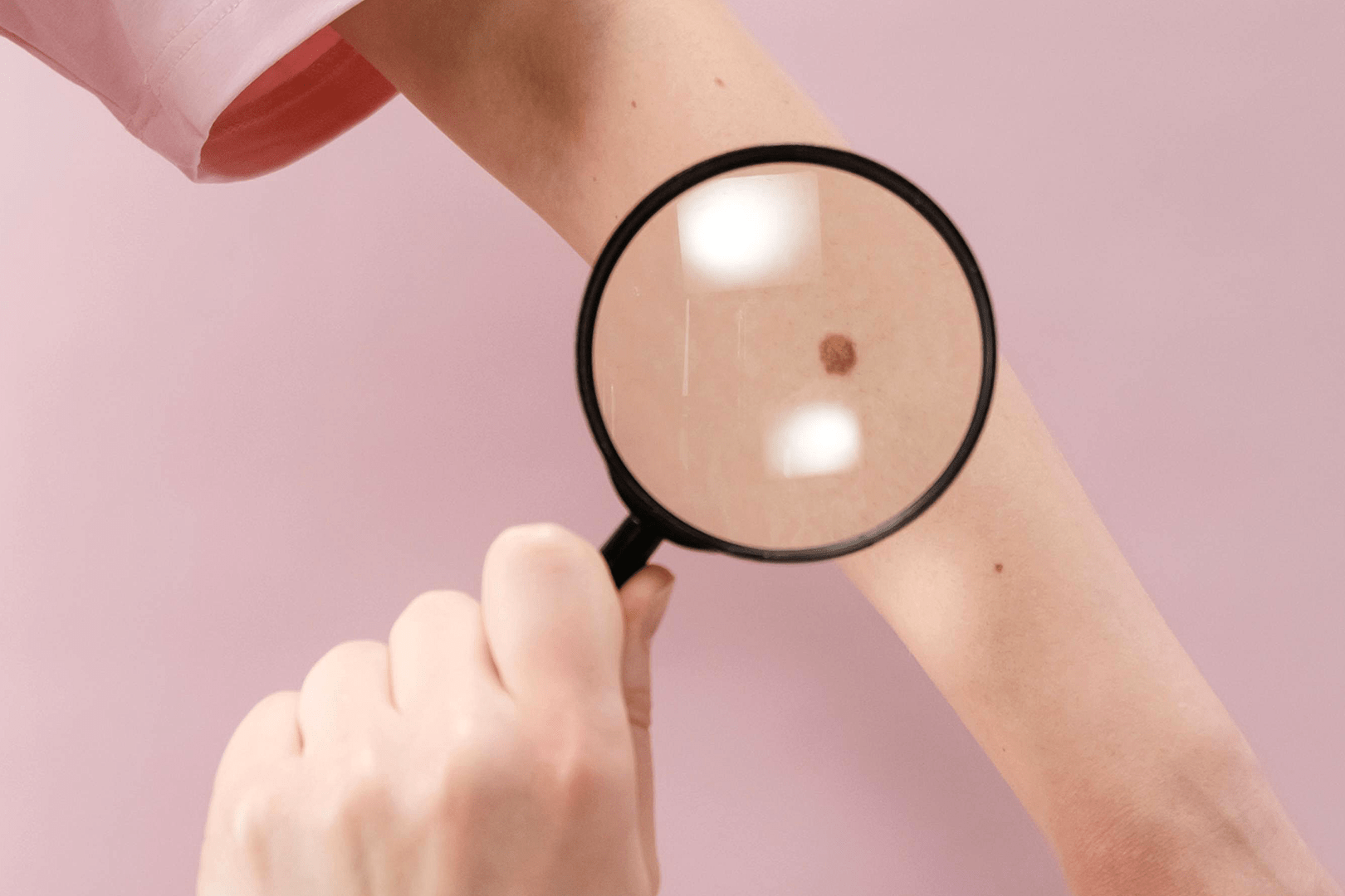Specjaliści od skóry – czym zajmuje się dermatolog?